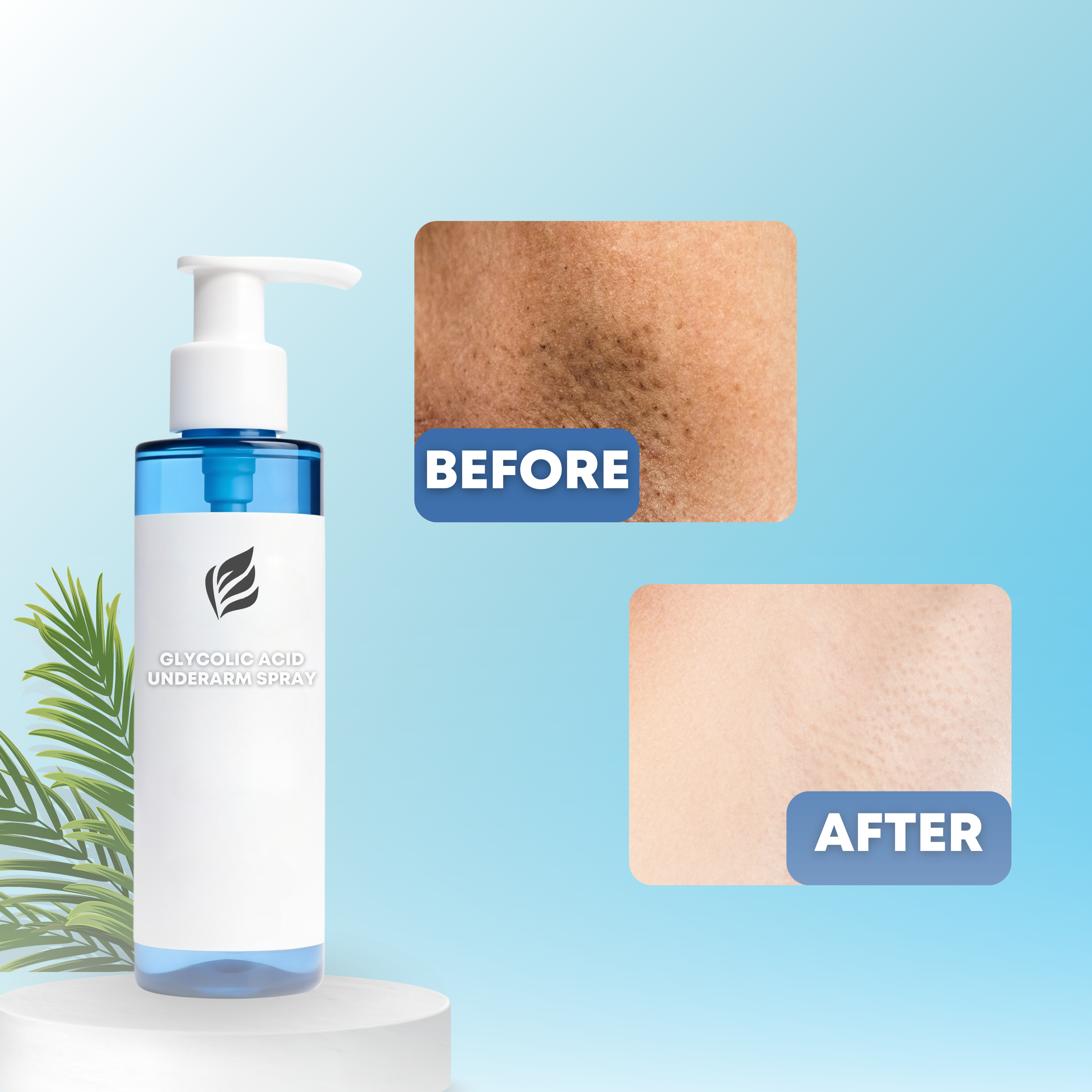 5% Glycolic Acid Underarm Brightening Spray Cream