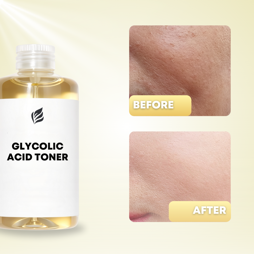 Glycolic Acid 7% Facial Toner