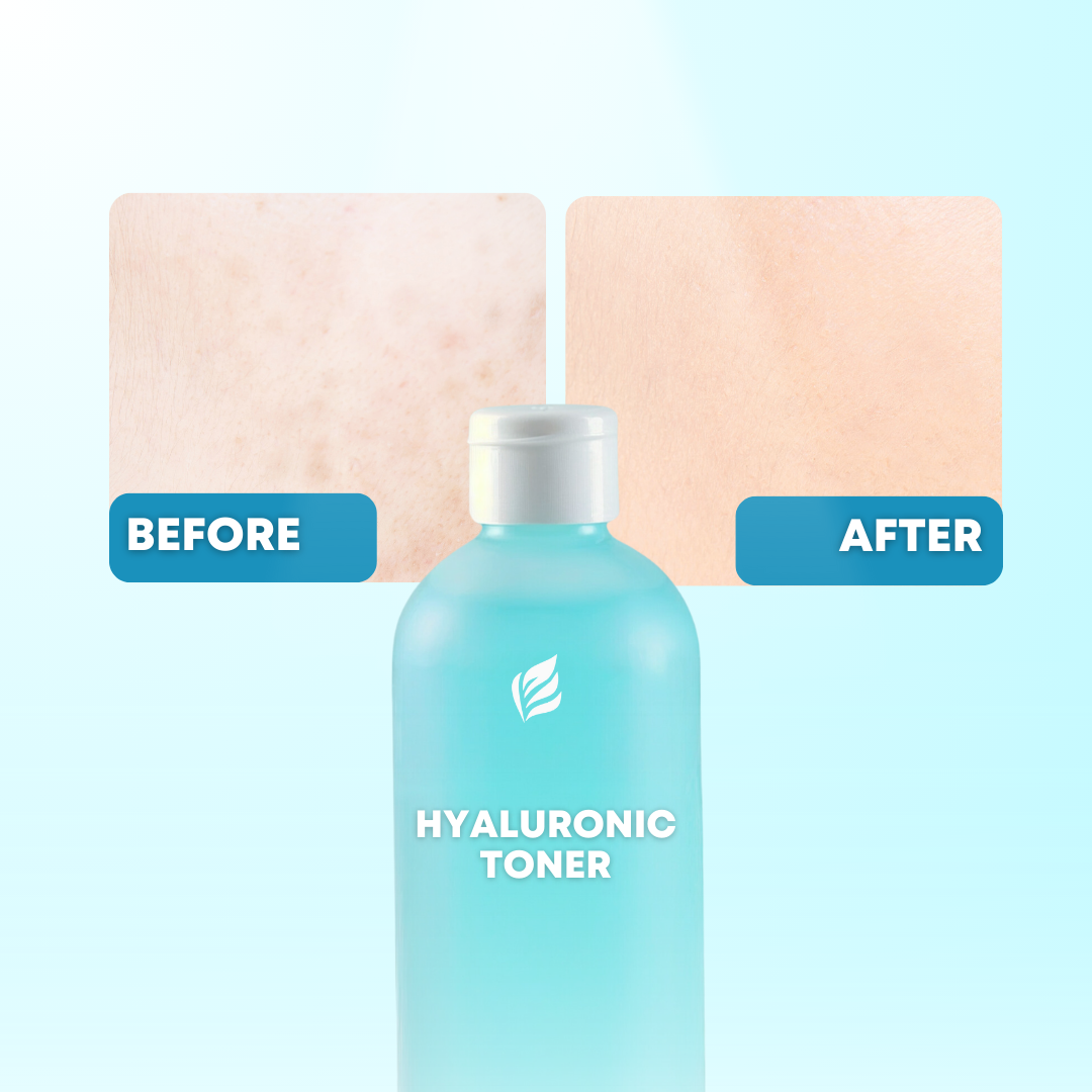 Low Ph Facial Toning Water Hydrating Hyaluronic Acid Toner