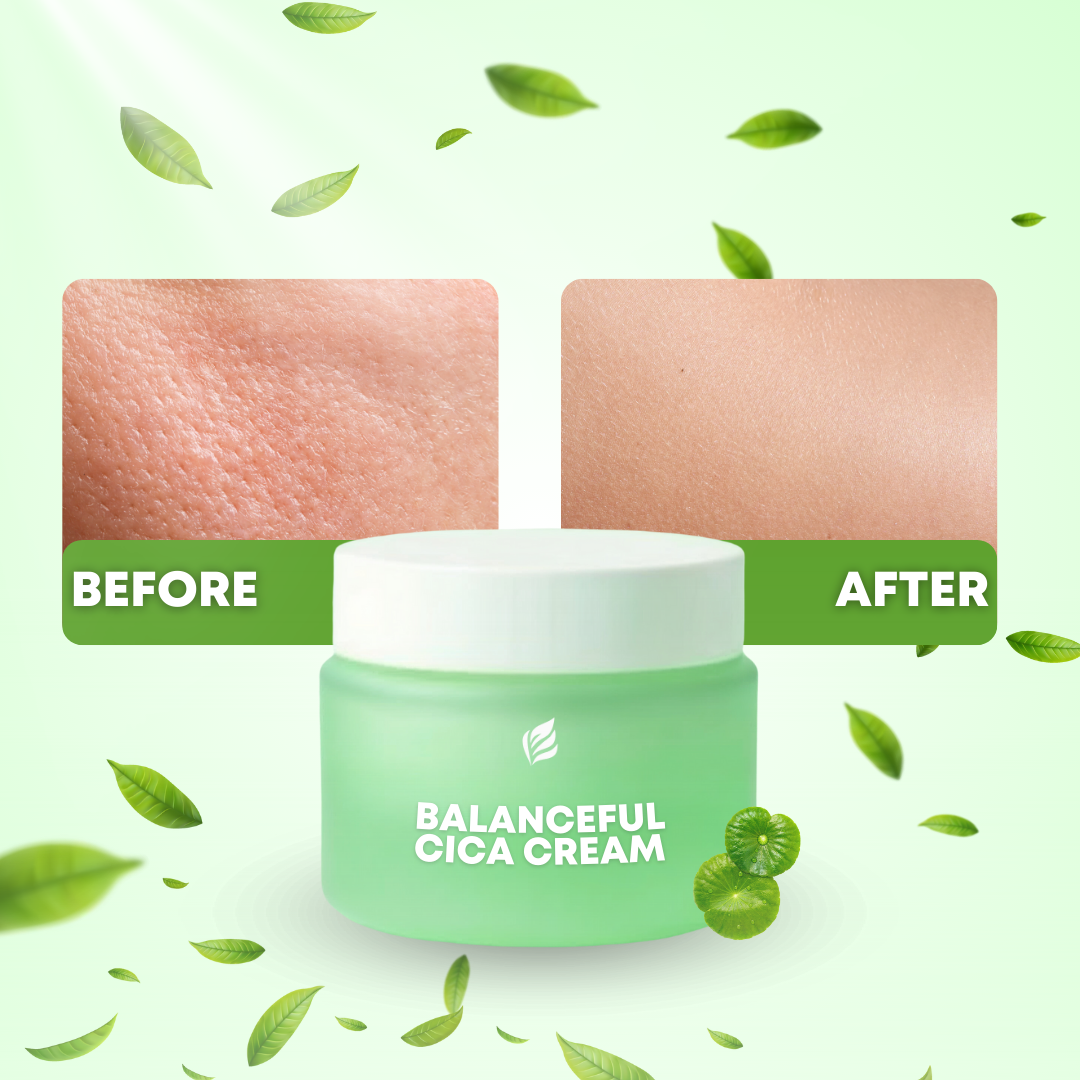 Acne Treatment Face Moisturizer with Centella Asiatica