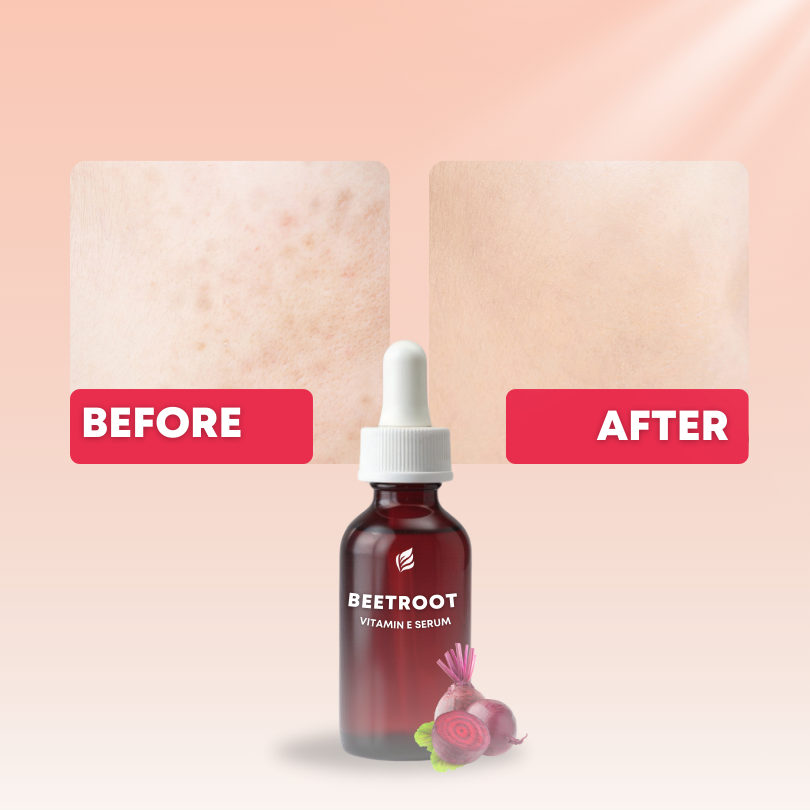 Beetroot Vitamin E Serum with Rosehip Oil