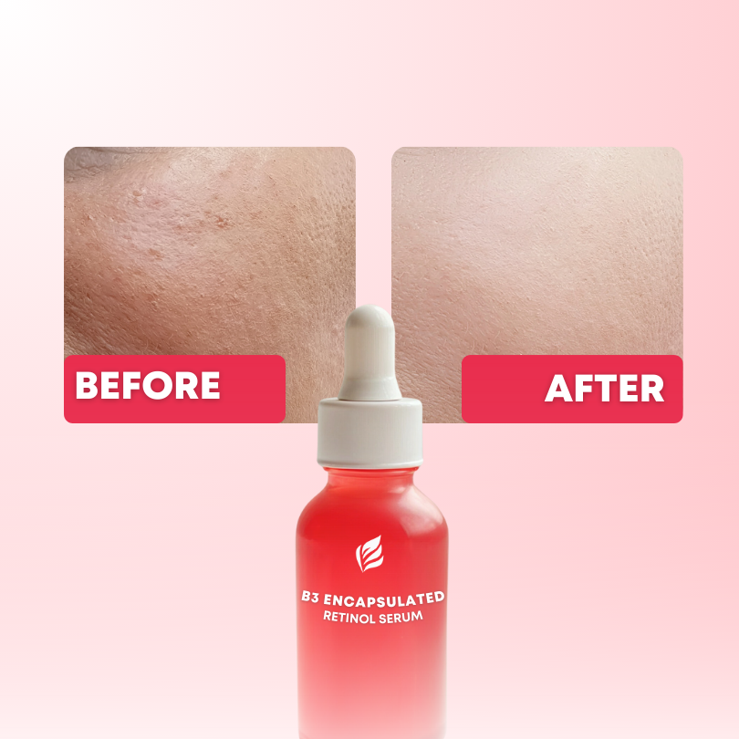 B3 Encapsuled Retinol Serum