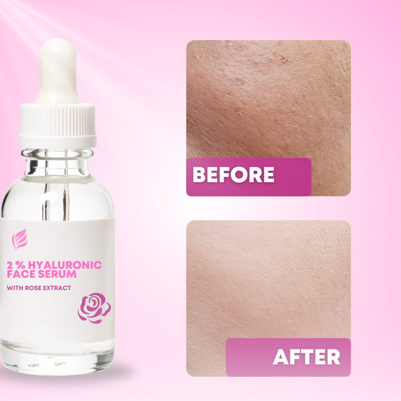 2% Sodium Hyaluronate Face Serum with Rose Extract