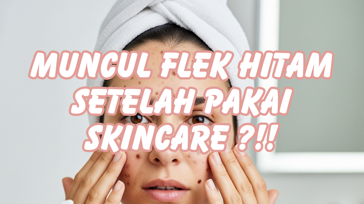 Penyebab Skincare Bikin Flek Hitam Pada Wajah