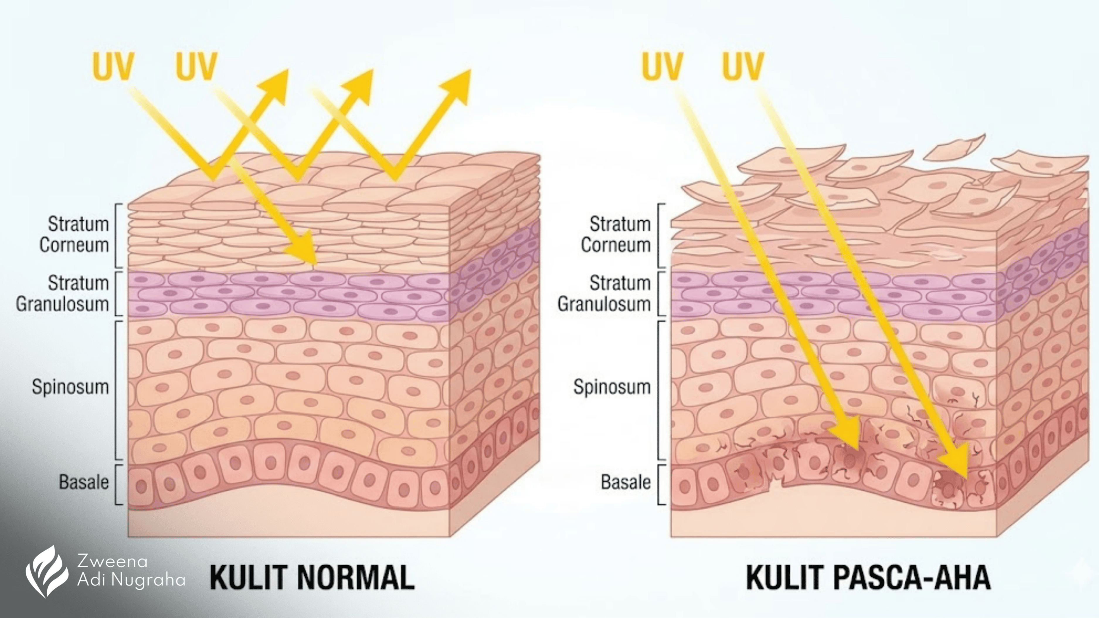 Daftar Zat Aktif Skincare Berbahaya