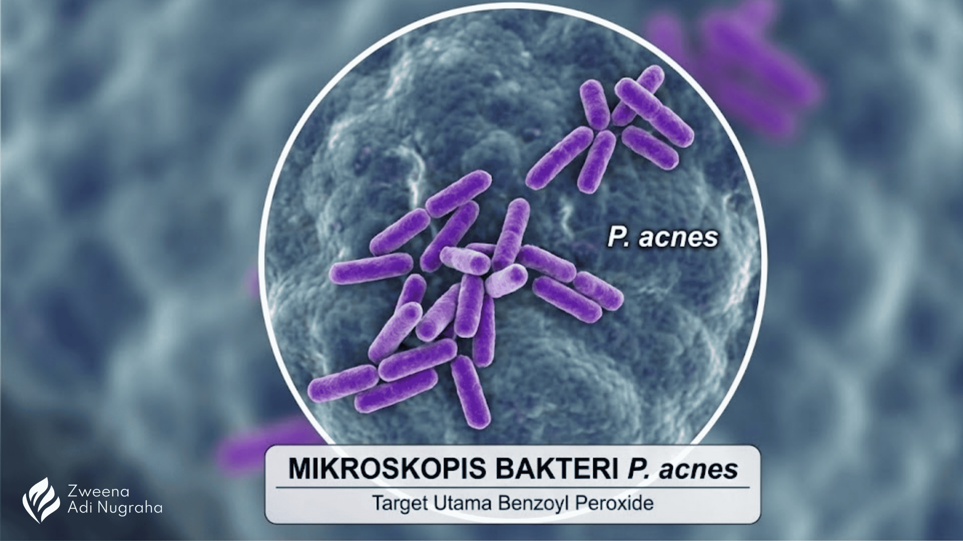 Daftar Zat Aktif Skincare Berbahaya